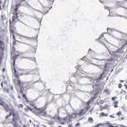 Immunohistochemical staining of human colon using Anti-GRK1 antibody HPA059376.