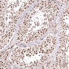 Immunohistochemical staining of human testis shows moderate nuclear positivity in cells in seminiferous ducts.
