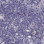 Immunohistochemical staining of human lymph node using Anti-GRK1 antibody HPA059376.