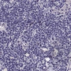 Immunohistochemical staining of human lymph node using Anti-GRK1 antibody HPA059376.