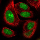 Anti-ZNF593 Antibody