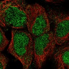 Anti-HIC2 Antibody