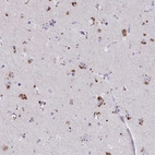 Anti-WDR97 Antibody
