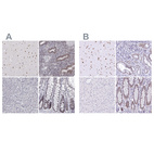 Anti-HNRNPA0 Antibody