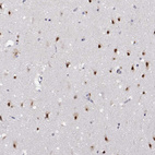 Anti-HNRNPA0 Antibody