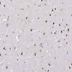 Immunohistochemical staining of human cerebral cortex shows strong nuclear positivity in neurons.