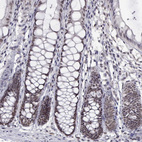 Immunohistochemical staining of human colon shows moderate nuclear positivity in glandular cells.