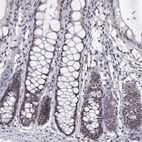 Anti-HNRNPA0 Antibody