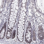 Immunohistochemical staining of human colon shows moderate nuclear positivity in glandular cells.