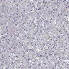 Immunohistochemical staining of human liver shows no nuclear positivity in hepatocytes as expected.