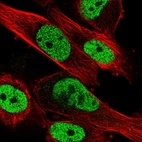 Immunofluorescent staining of human cell line U-251 MG shows localization to nucleoplasm.