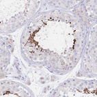 Anti-VWC2L Antibody