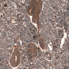 Immunohistochemical staining of human endometrium shows strong cytoplasmic positivity in glandular cells.