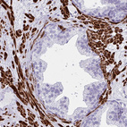 Immunohistochemical staining of human prostate shows strong cytoplasmic positivity in smooth muscle cells.
