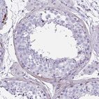 Immunohistochemical staining of human testis shows weak cytoplasmic positivity in peritubular myoid cells.