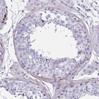 Anti-GRXCR2 Antibody