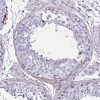Immunohistochemical staining of human testis shows weak cytoplasmic positivity in peritubular myoid cells.