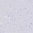 Immunohistochemical staining of human cerebral cortex shows no positivity in neurons as expected.