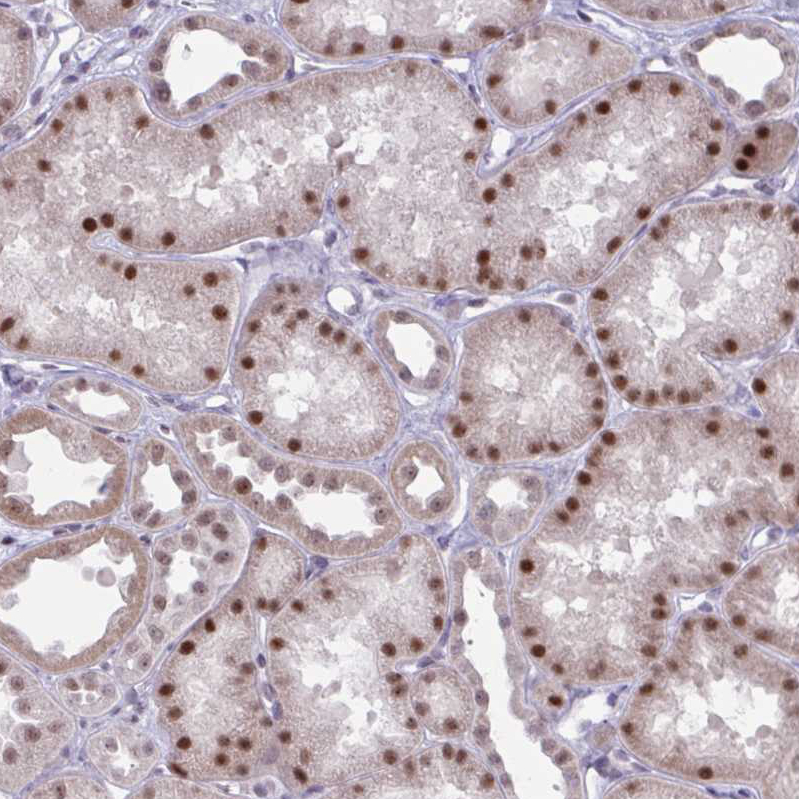 Anti-PRMT6 Antibody