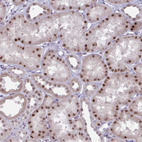 Anti-PRMT6 Antibody