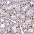 Anti-PRMT6 Antibody