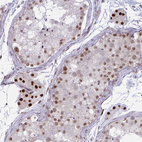 Anti-PRMT6 Antibody