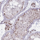Immunohistochemical staining of human testis shows strong nuclear positivity in Leydig cells.