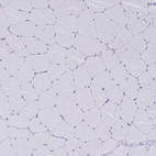 Immunohistochemical staining of human skeletal muscle shows no positivity in myocytes as expected.