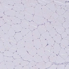 Immunohistochemical staining of human skeletal muscle shows no positivity in myocytes as expected.