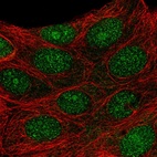 Immunofluorescent staining of human cell line MCF7 shows localization to nucleus & nucleoli.