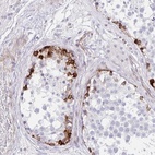 Anti-ZNF713 Antibody