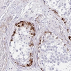 Anti-ZNF713 Antibody