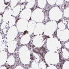 Anti-ZNF221 Antibody