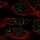 Immunofluorescent staining of human cell line RH-30 shows localization to nuclear bodies.