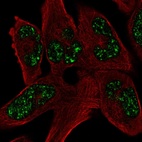 Anti-SOHLH1 Antibody