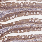Anti-HOXD12 Antibody