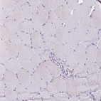 Immunohistochemical staining of human skeletal muscle shows no positivity in myocytes as expected.