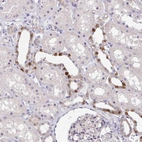 Immunohistochemical staining of human kidney shows strong nuclear positivity in a subset of cells in tubules.