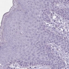 Immunohistochemical staining of human skin shows no positivity in squamous epithelial cells as expected.
