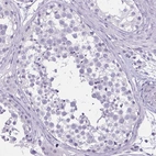 Immunohistochemical staining of human testis shows no positivity in cells in seminiferous ducts as expected.