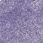 Immunohistochemical staining of human lymph node shows no positivity in non-germinal center cells as expected.