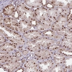 Anti-NMNAT1 Antibody