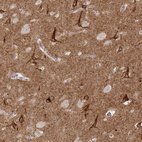 Anti-SLC9A6 Antibody