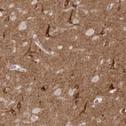 Immunohistochemical staining of human cerebral cortex shows strong granular cytoplasmic positivity in neurons.