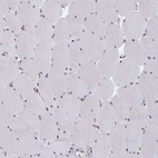 Immunohistochemical staining of human skeletal muscle shows weak nuclear positivity in myocytes.