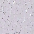 Immunohistochemical staining of human skeletal muscle shows weak nuclear positivity in myocytes.