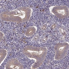 Immunohistochemical staining of human endometrium shows moderate cytoplasmic positivity in glandular cells.
