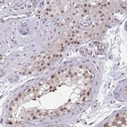 Immunohistochemical staining of human testis shows moderate nuclear positivity in cells in seminiferous ducts.