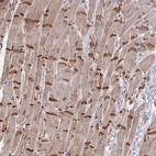 Immunohistochemical staining of human heart muscle shows strong positivity in the intercalated discs in cardiomyocytes.