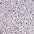 Immunohistochemical staining of human liver shows moderate nuclear positivity in hepatocytes.